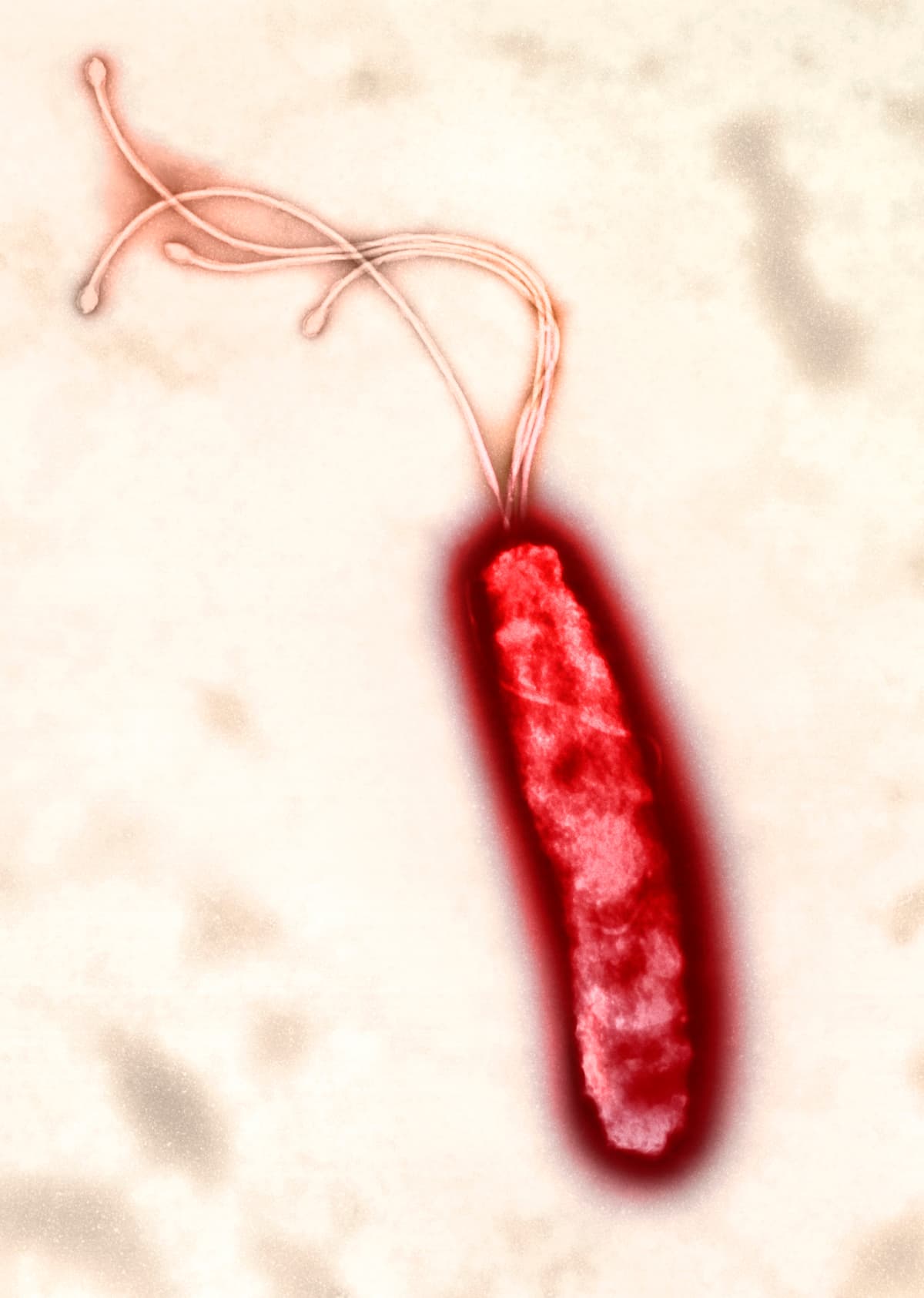 Helicobacter pylori bacterium, coloured transmission electron micrograph (TEM).