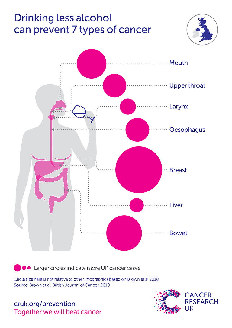 Drinking less alcohol can prevent 7 types of cancer. Cancer most commonly caused by alcohol includes breast, bowel and mouth.