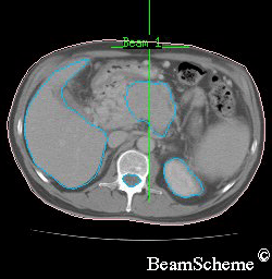 CT scan cross section.