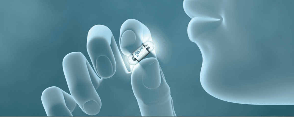 Illustration of a patient taking a pill cam.