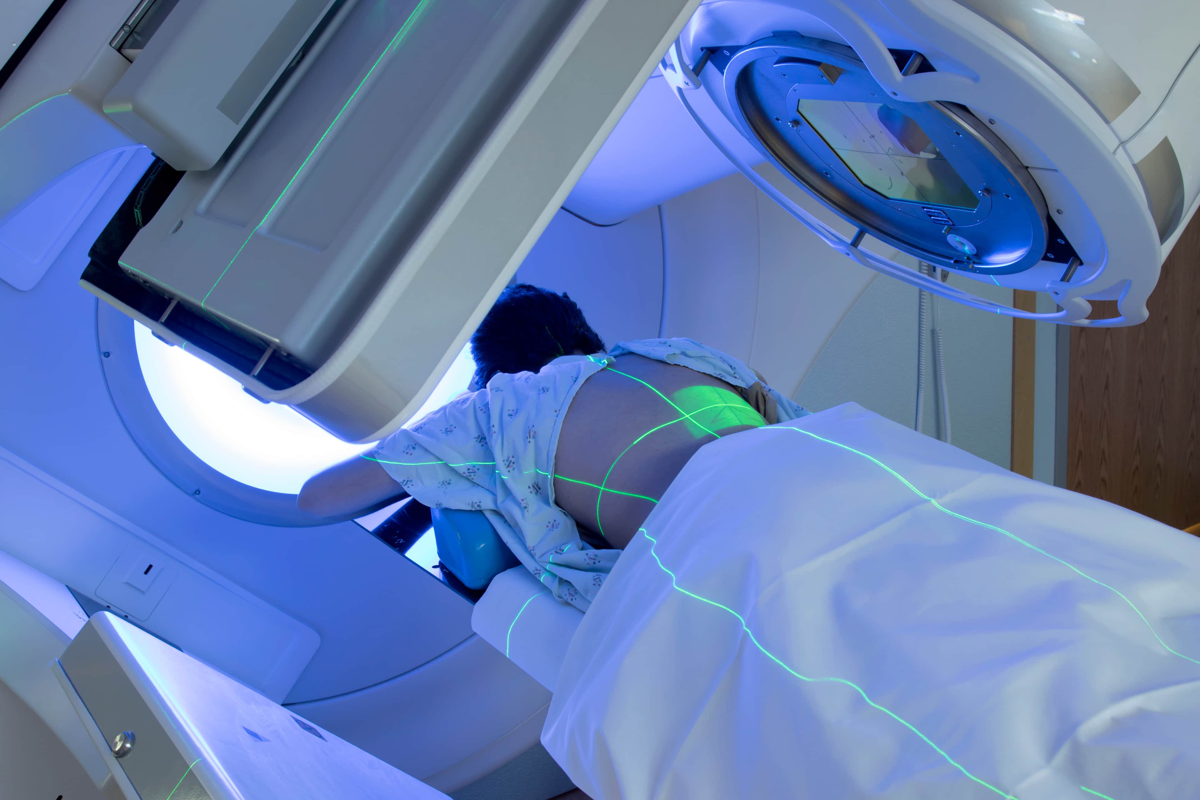 Young Woman Receiving Radiation Therapy Treatments for Cancer.