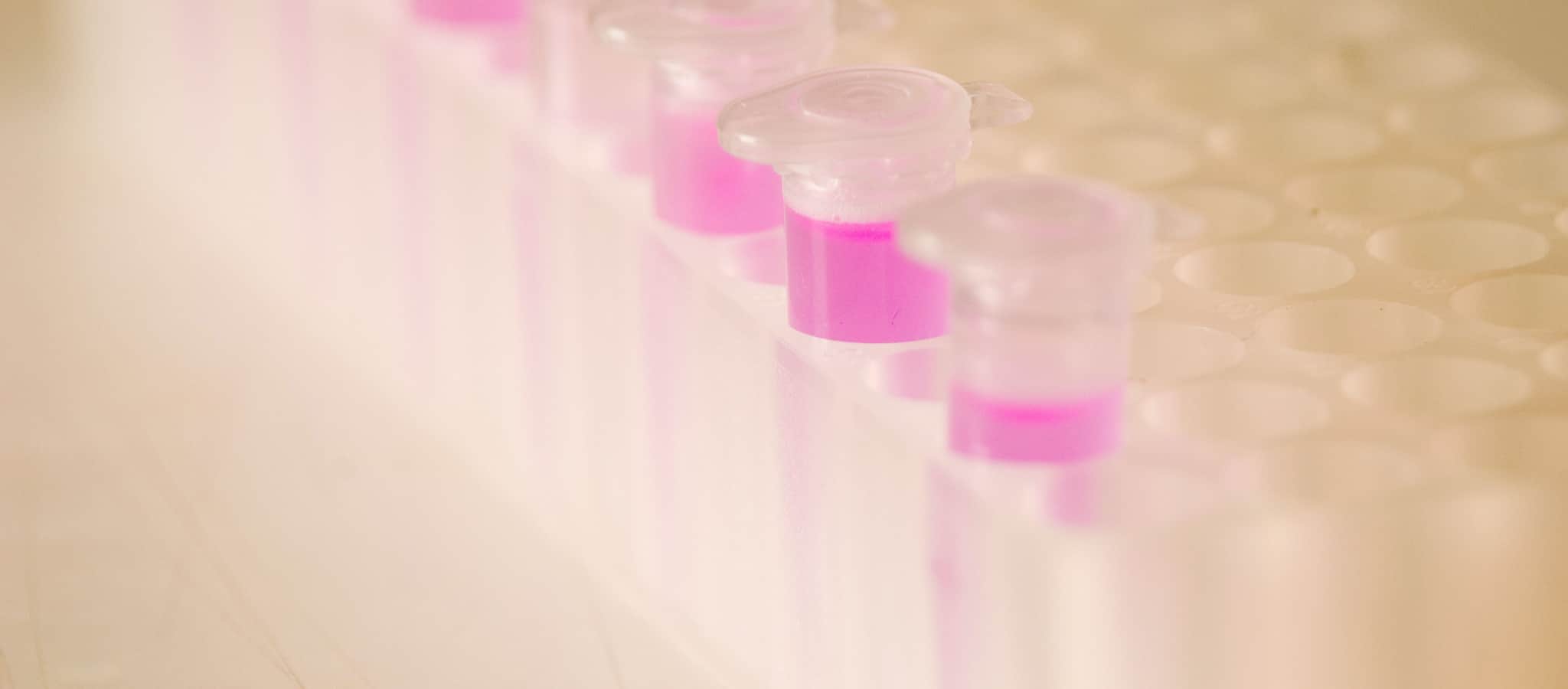 Test tube samples.
