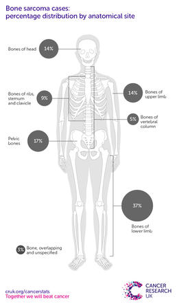 A infographic showing the most common specific location for bone sarcomas in the UK is the lower limb (2016-2018).