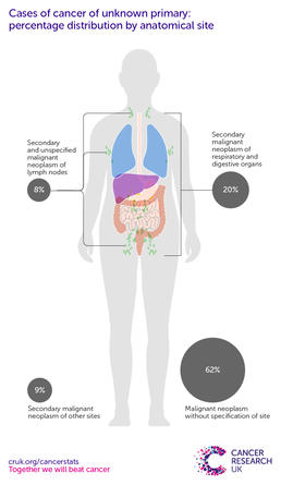 Infographic showing cancers of unknown primary 