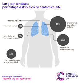 an infographic showing the most common specific location for lung cancers in the UK is the upper lobe of the bronchus or lung (2016-2018).